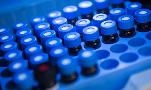 Bioinformatics in Assay Development