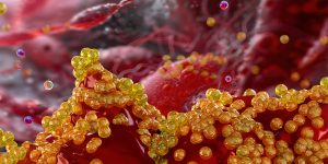 mrsa